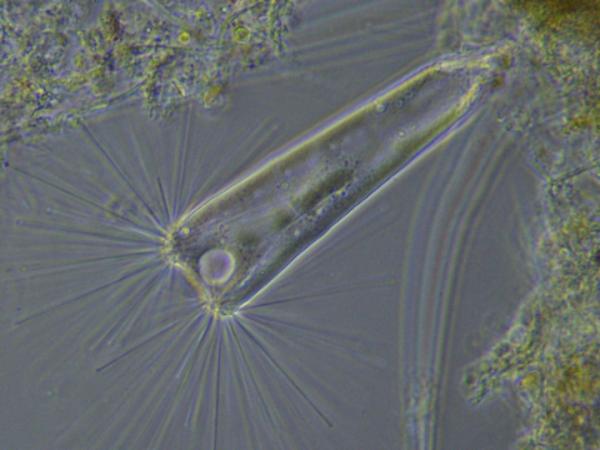 Bresser MicroCamII 0.4 UHSP Hochgeschwindigkeitskamera für Mikroskope